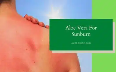 Aloe Vera For Sunburn [How to Use & Does it Works?]