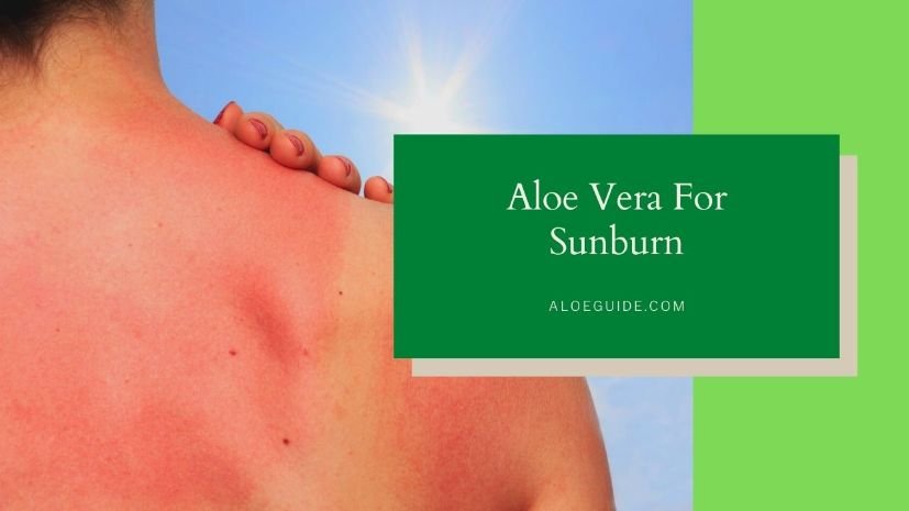 Aloe Vera For Sunburn