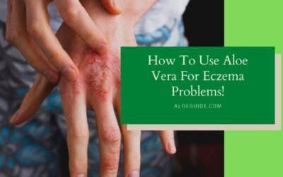 Aloe Vera For Eczema – Benefits & Uses