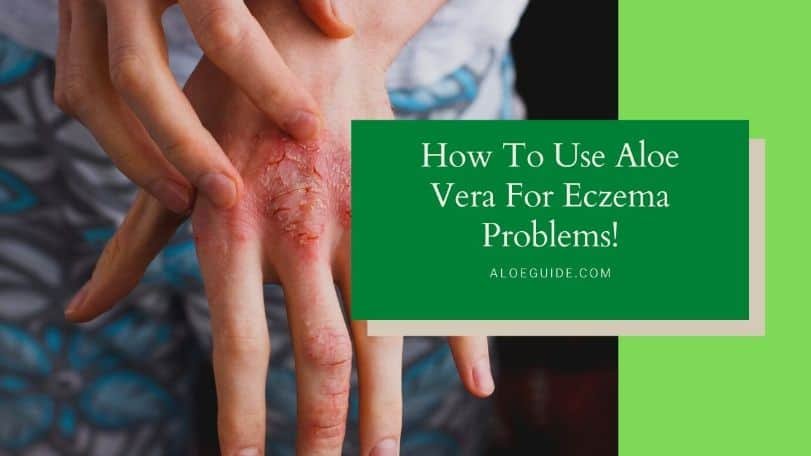 Aloe Vera For Eczema