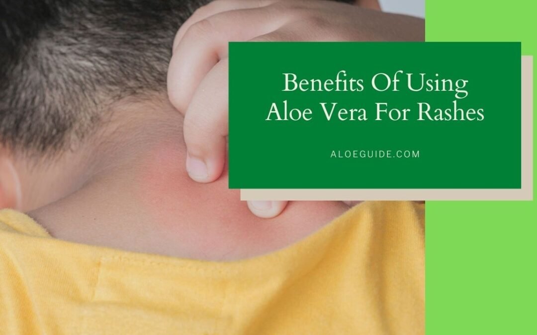 Best Guide Using Aloe Vera For Rashes [2021]