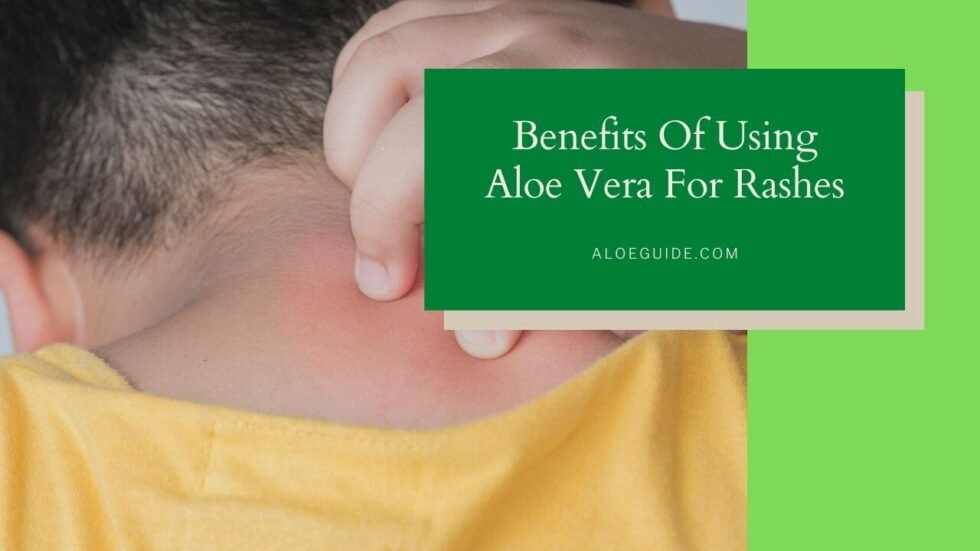 Aloe Vera For Rashes Research Efficacy And More Aloe Guide 9192