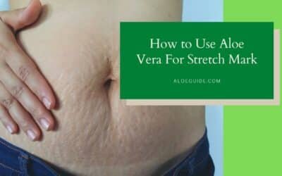 Benefits of Using Aloe Vera For Stretch Marks!
