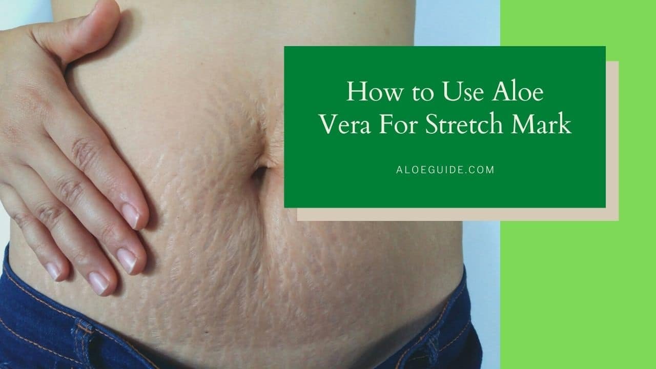 Aloe Vera For Stretch Marks